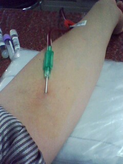 献血的针头.